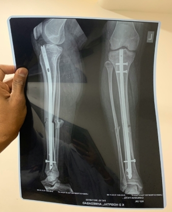 ortho-6